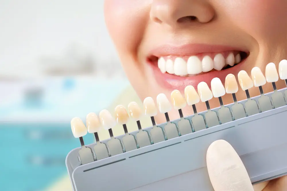 Eugene dental veneers with Wellness Centered Dentistry.